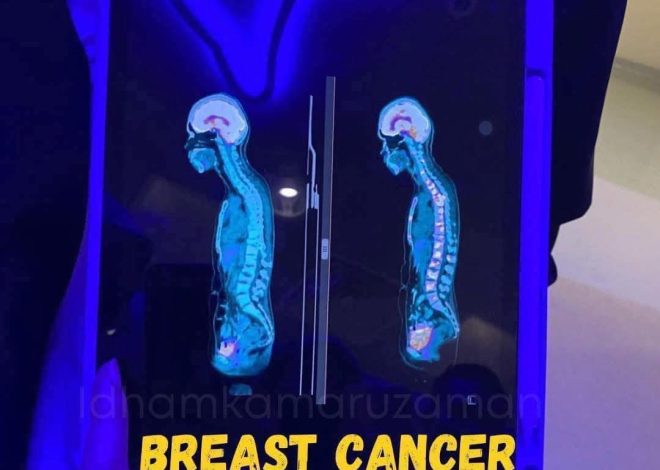 Detik Mengubah Hidup: Kisah Sel Kanser yang ‘Padam’ dan Realiti Rawatan Yang Tidak Pernah Kita Nampak