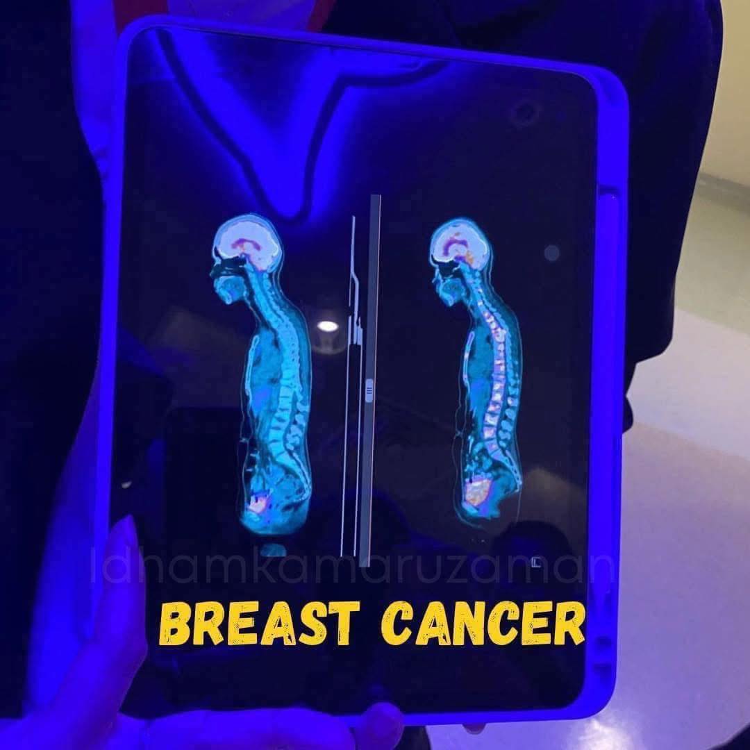 Detik Mengubah Hidup: Kisah Sel Kanser yang ‘Padam’ dan Realiti Rawatan Yang Tidak Pernah Kita Nampak